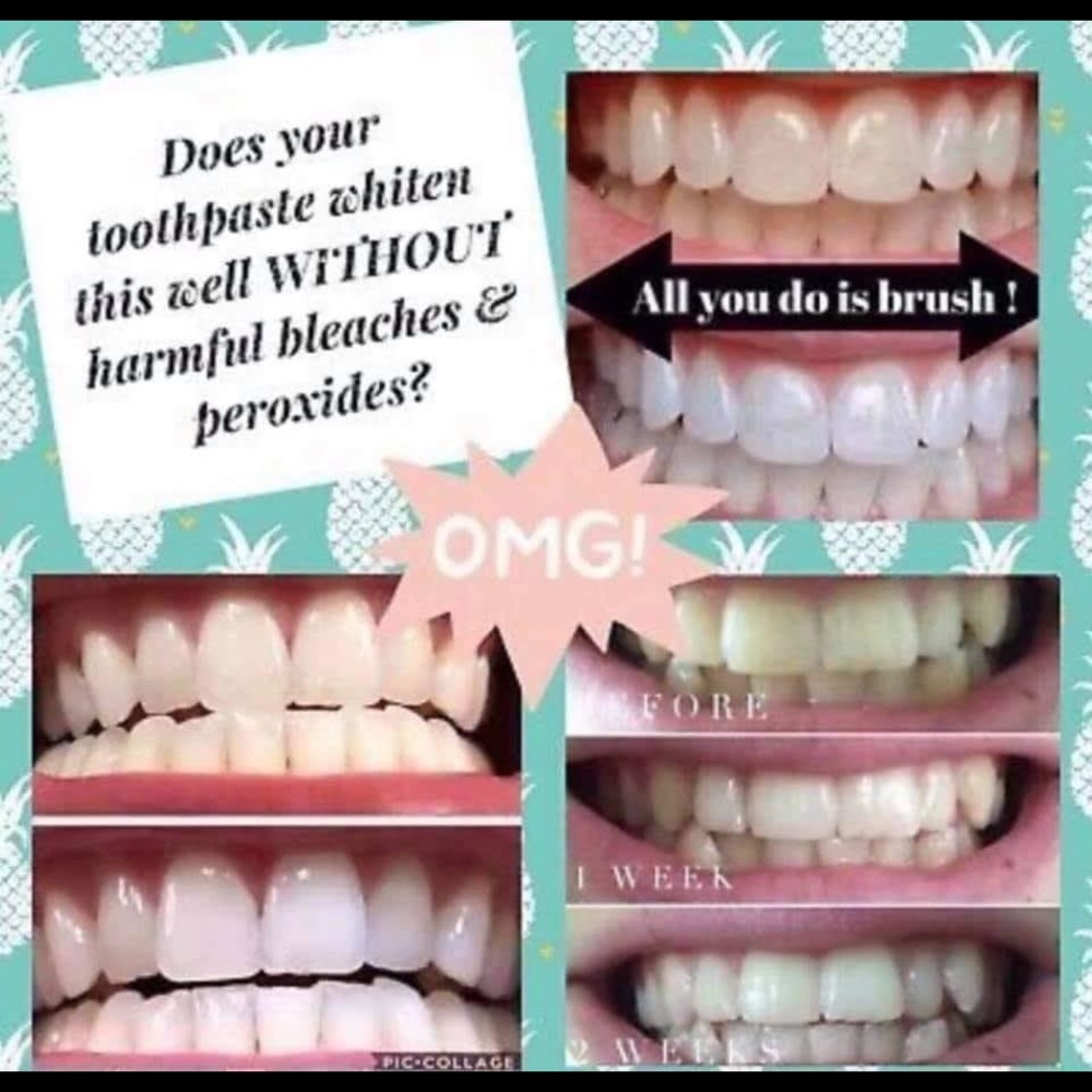 Whitening toothpaste! - Picture 5 of 11